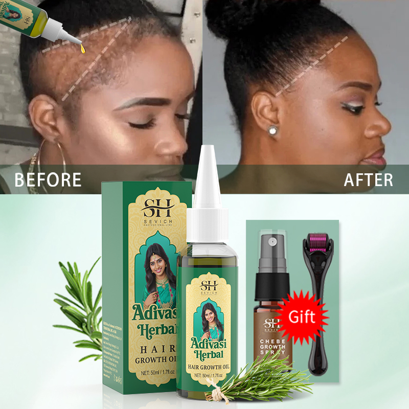 Óleo Ayurvédico para Crescimen - Hair Care Essence Oil Spray avaliação e preço