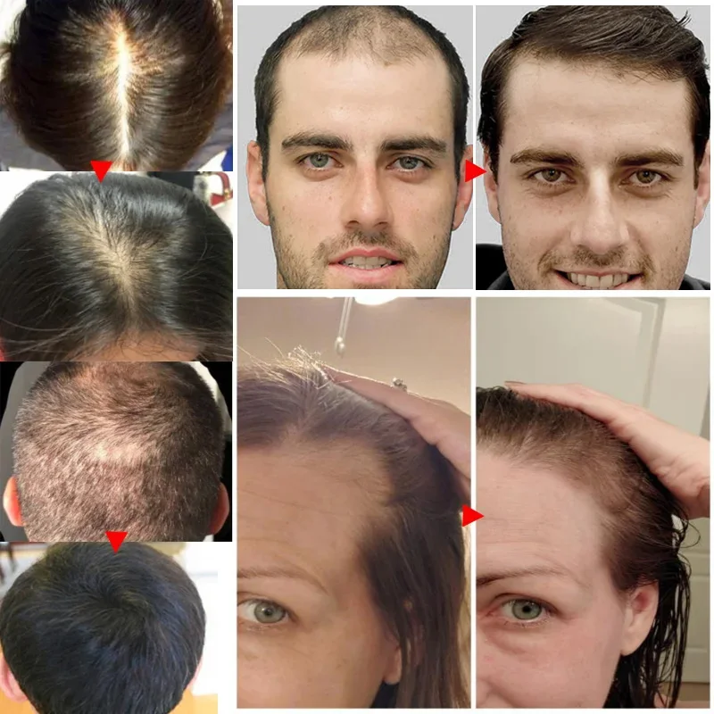 Óleo Essencial de Crescimento  - Hair Care Essential Oil Atomizing avaliação e preço