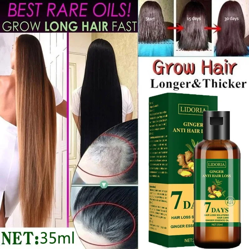 Óleo Essencial de Crescimento  - Hair Care Essential Oil Atomizing avaliação e preço