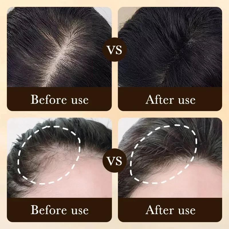 Óleo de Crescimento Rápido de  - Hair Care Essence Oil Spray avaliação e preço