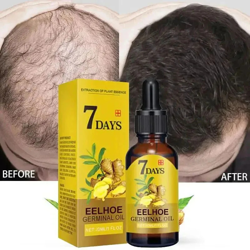 Sérum de Crescimento Rápido de - Hair Care Essential Oil Atomizing avaliação e preço