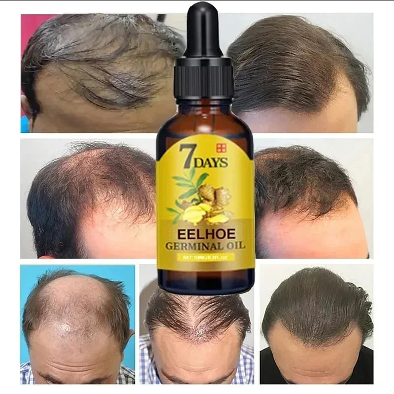 Sérum de Crescimento Rápido de - Hair Care Essential Oil Atomizing avaliação e preço