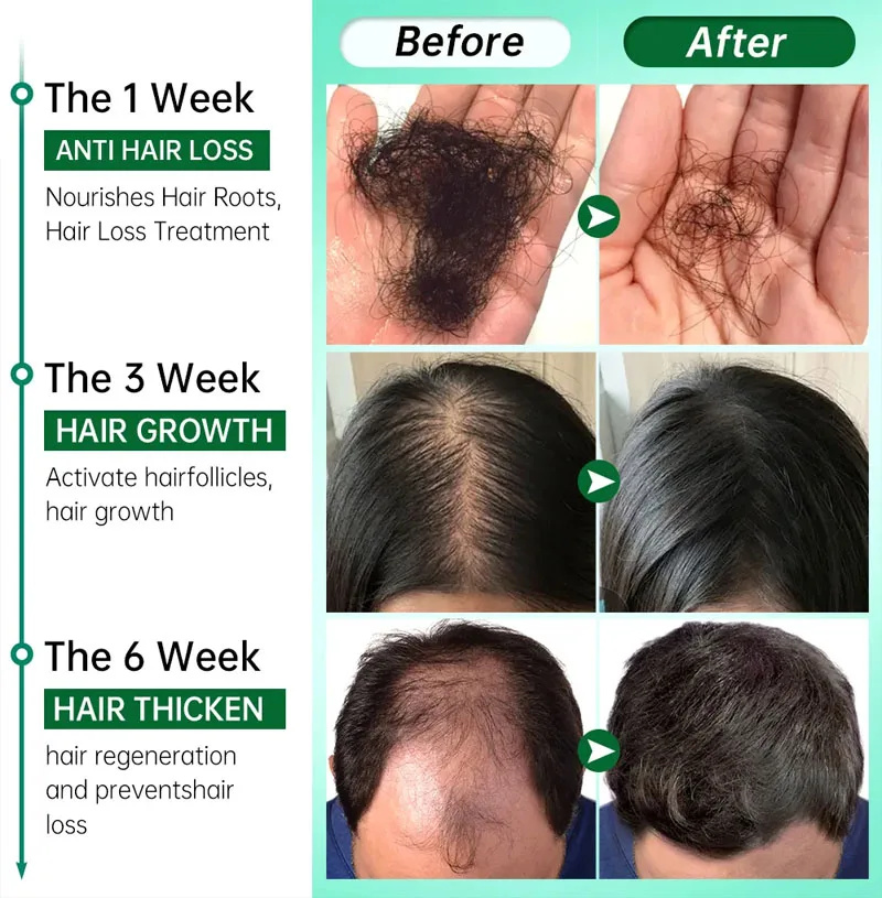 Sérum de Crescimento Rápido de - Hair Care Essential Oil Atomizing avaliação e preço
