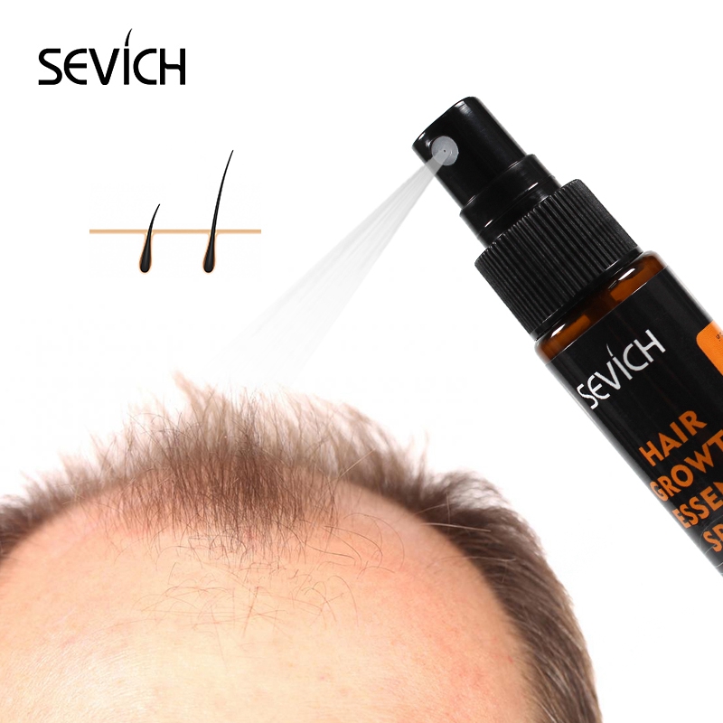 Sevich-Spray rápido do crescim - Hair Care Essence Oil Spray avaliação e preço