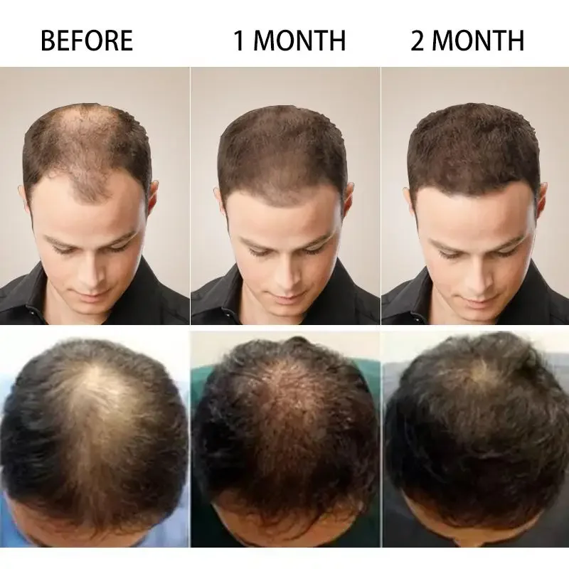 Crescimento do cabelo gengibre - Hair Care Essence Oil Spray avaliação e preço